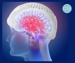 Estimulacion Magnetica Transcraneal