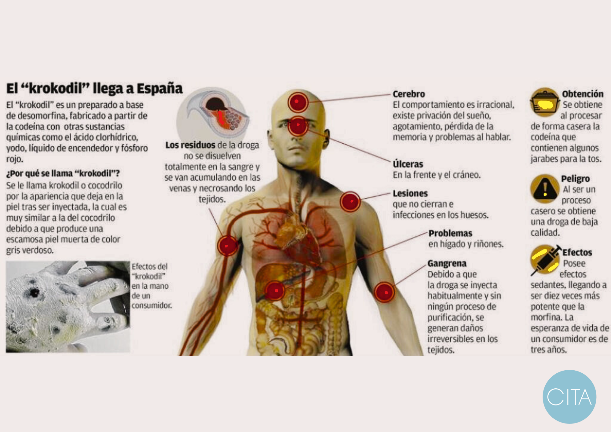 efecto krokodil